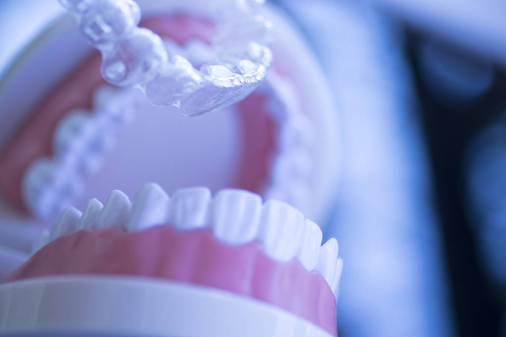 Get the Best Invisalign Care in Joondalup WA at an Affordable Price
