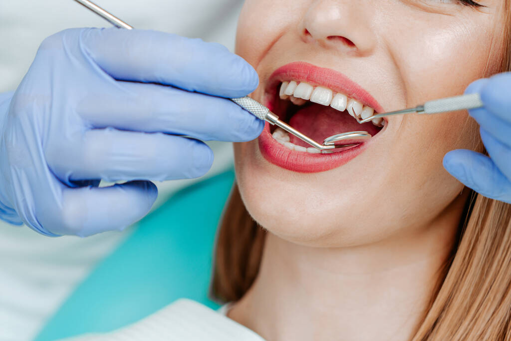 Dental Implants Perth 